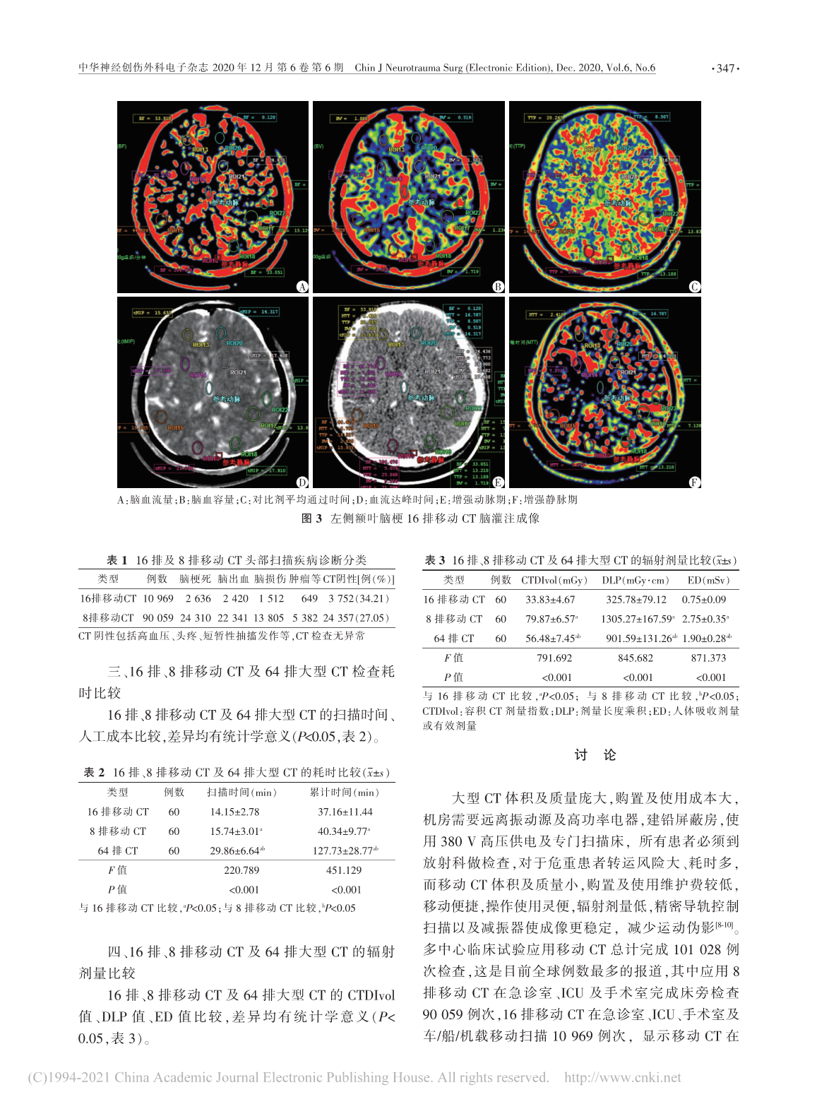 16排及8排移动CT 多中心临床应用对比分析